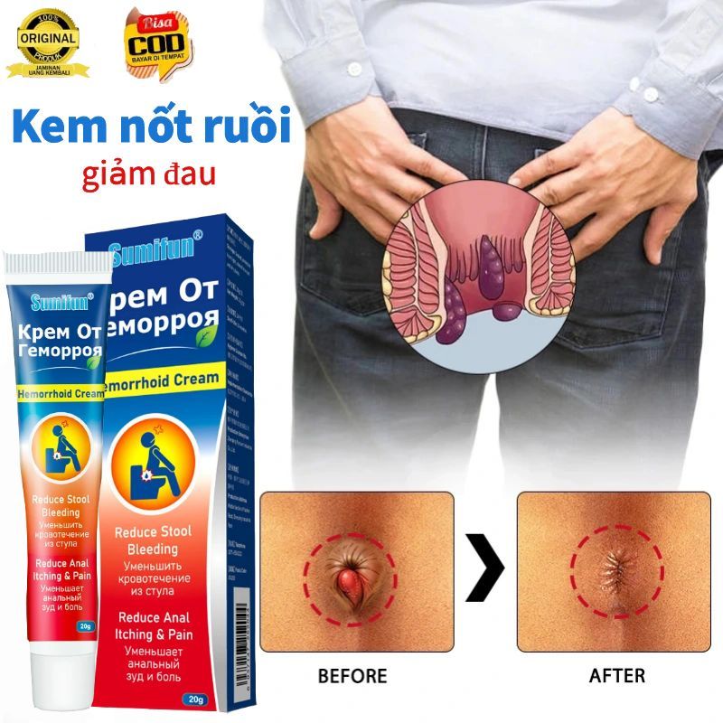 Kem bôi trĩ gel Hỗ Trợ Giảm Bệnh Trĩ giúp co búi trĩ đau rát hậu môn làm giảm sưng trĩ Chảy máu khi đi tiêu