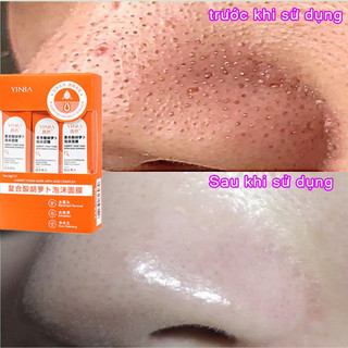 Mặt Nạ Sủi Bọt lột mụn đầu đen mặt nạ cà rốt sủi bọt mặt nạ lột mụn đầu đen trắng da mặt lột mụn đầu đen mũi