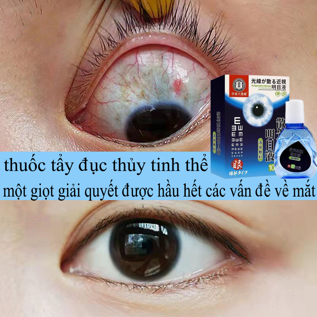 Nhỏ mắt Nhật khô mắt mỏi mắt dưỡng đục thủy tinh thể loạn thị cận thị mắt đau mắt mắt đỏ 10ml