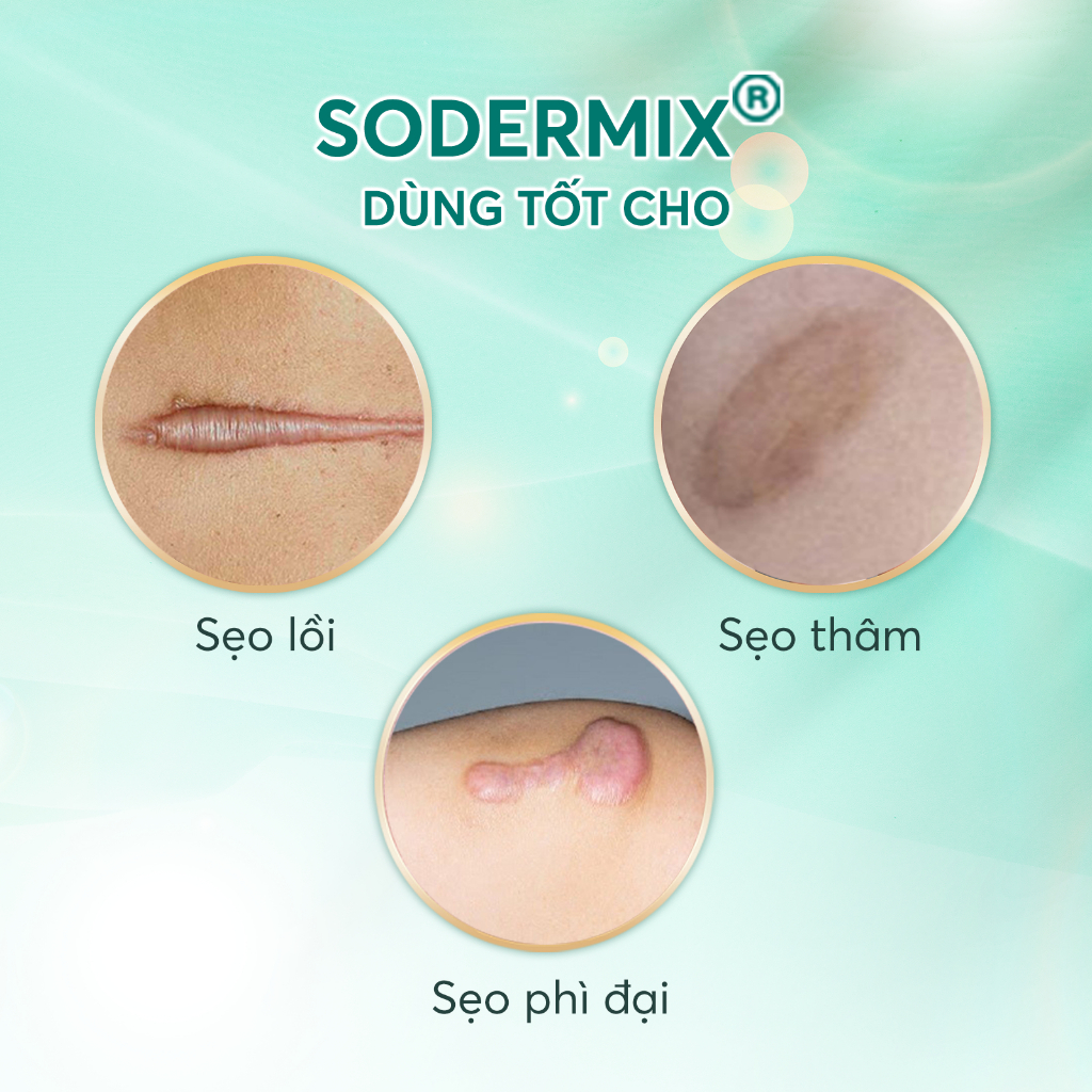 SODERMIX® Kem Bôi Sẹo Lồi, Sẹo Thâm, Sẹo Phì Đại - Nhập Khẩu Nguyên Hộp Từ Pháp - Hàng Chính Hãng