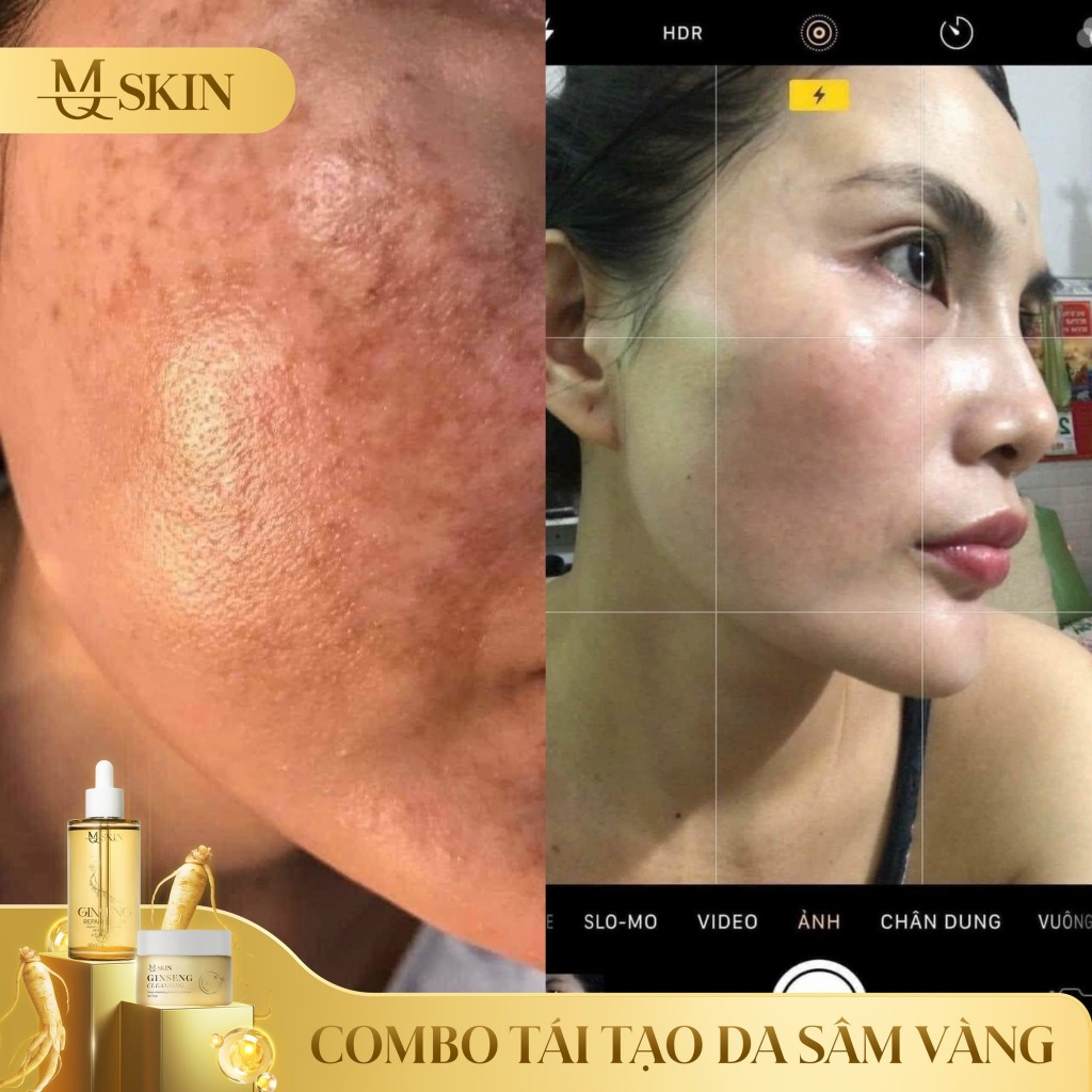 Combo tái tạo da sâm vàng MQ SKIN thay da nhân sâm mq skin,bột rửa mặt mqskin tr.i mụn nám tàn nhang | BigBuy360 - bigbuy360.vn