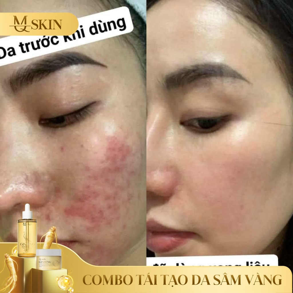 Combo tái tạo da sâm vàng MQ SKIN thay da nhân sâm mq skin,bột rửa mặt mqskin tr.i mụn nám tàn nhang | BigBuy360 - bigbuy360.vn