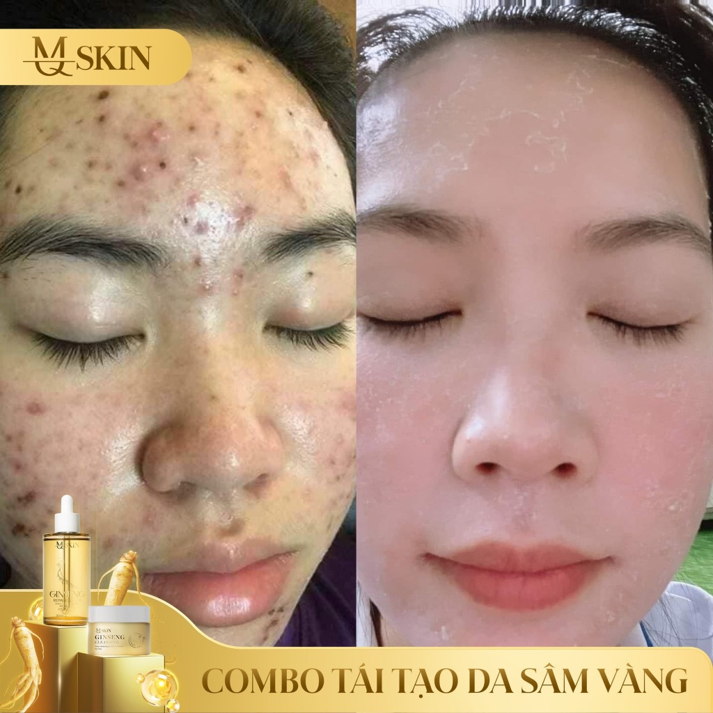 Combo tái tạo da sâm vàng MQ SKIN thay da nhân sâm mq skin,bột rửa mặt mqskin tr.i mụn nám tàn nhang | BigBuy360 - bigbuy360.vn