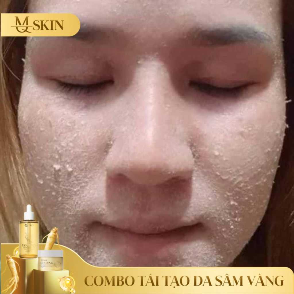 Combo tái tạo da sâm vàng MQ SKIN thay da nhân sâm mq skin,bột rửa mặt mqskin tr.i mụn nám tàn nhang | BigBuy360 - bigbuy360.vn