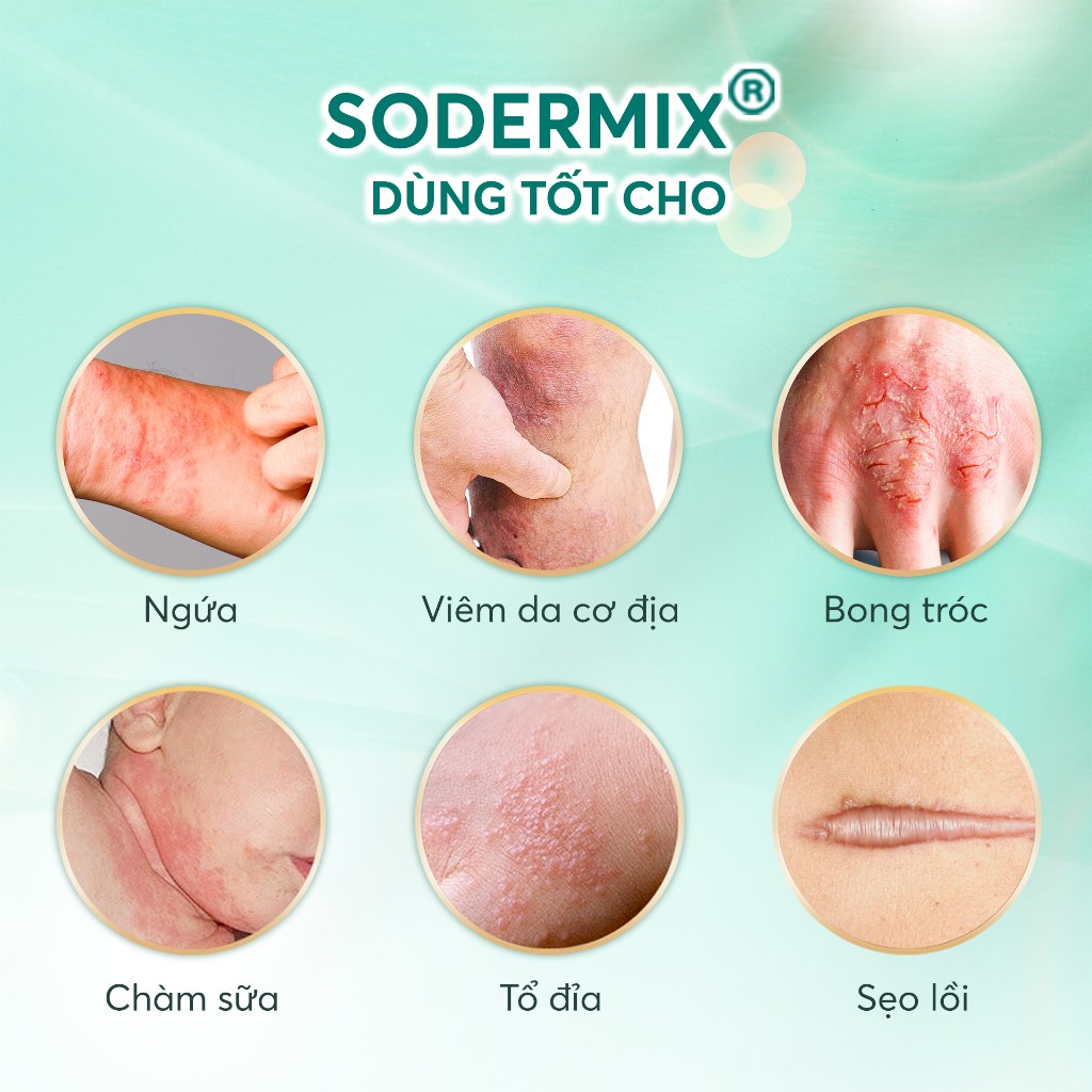 [MUA 2 TẶNG 1] Commbo 2 Tuýp SODERMIX Kem Bôi Viêm Da Cơ Địa, Ngứa Ngáy, Sẹo Nhập Khẩu Nguyên Hộp Từ Pháp 15gr