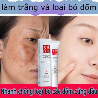 Kem loại bỏ nám trắng da trị thâm mụn tàn nhang Xóa nám chuyên sâu Loại bỏ nám da sáng rạng rỡ Kiềm dầu dưỡng ẩm