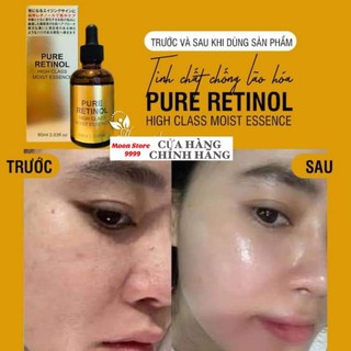 Serum chống lão hóa xóa nếp nhăn retinol pure high nhật bản chai 60ml