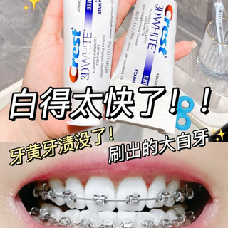 [Bản Trung] Kem đánh răng Crest 3D White Brilliance làm trắng răng