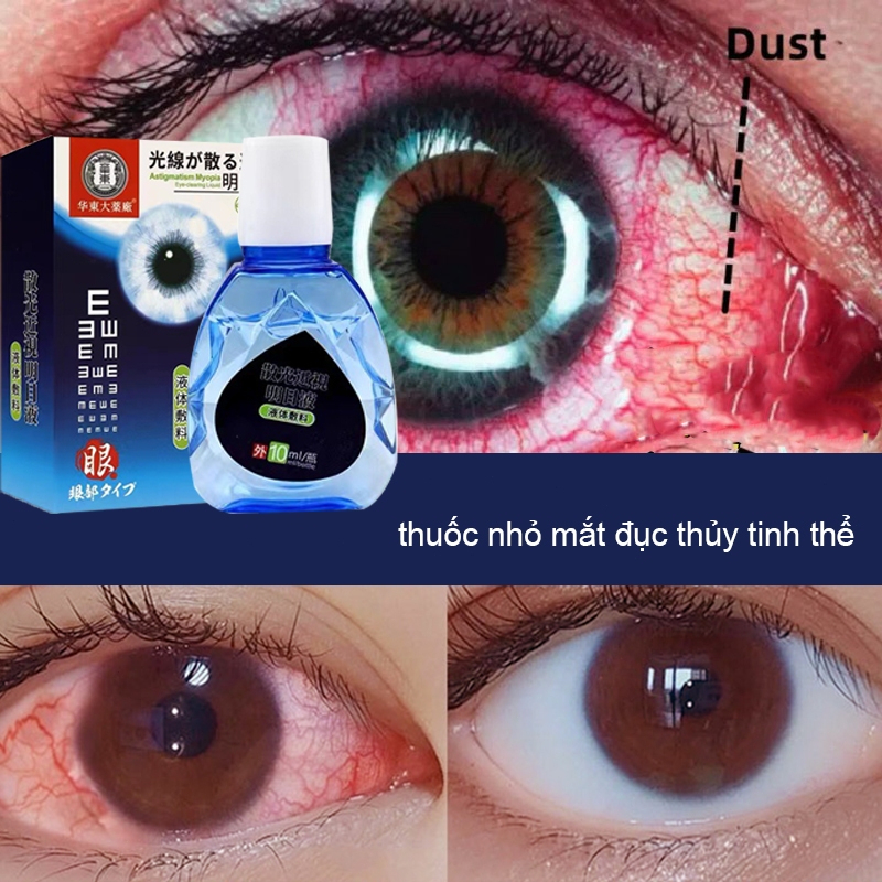 Nhỏ mắt nhật Sakura japan giảm đục thủy tinh thể 10ml nhỏ mắt nhân tạo