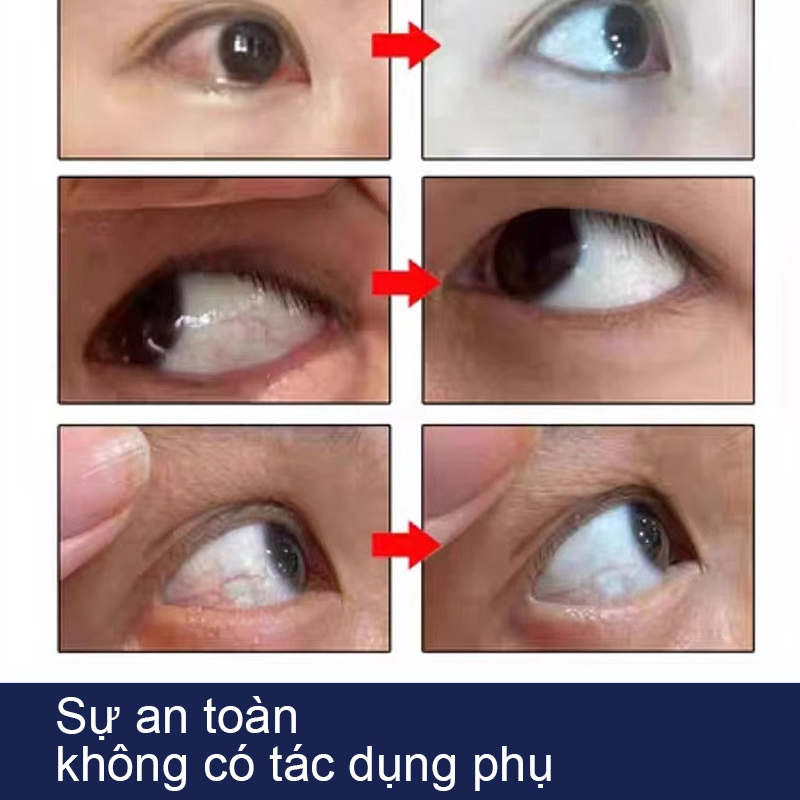 Nhỏ mắt nhật Sakura japan giảm đục thủy tinh thể 10ml nhỏ mắt nhân tạo