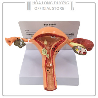 Mô hình mặt cắt ngang của tử cung dùng nghiên cứu giải phẫu chuyên nghiệp