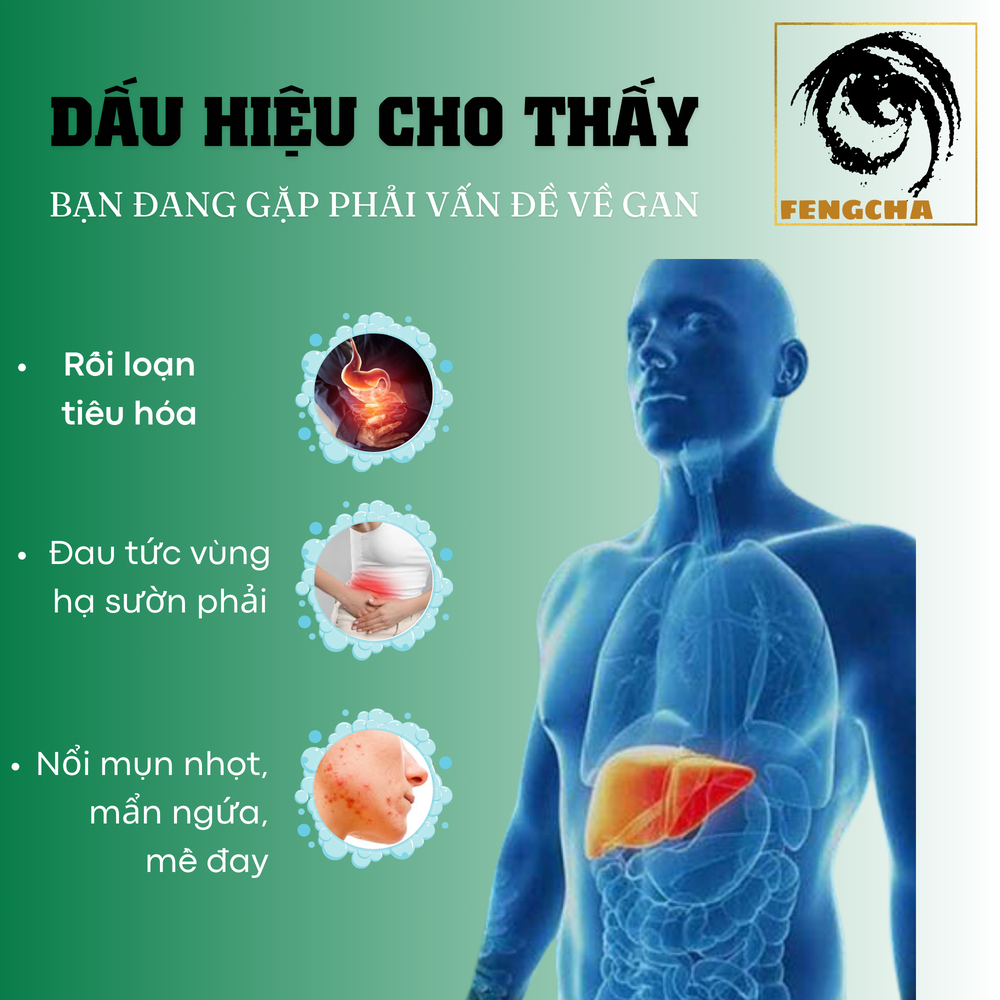 [Lá gan khỏe] Viên uống giải độc gan Fengcha đào thải nhanh các tế bào gan đã bị hư hại, tăng sinh tế bào mới bịch 450v
