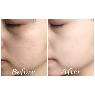 Phấn phủ kiềm dầu Shiseido
