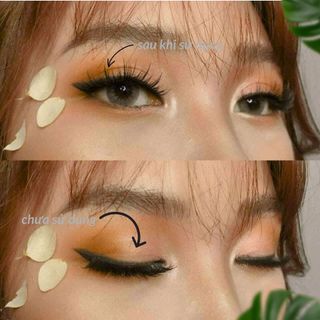 Kích Mí Lưới Keli Allergy Double Eyelid (60 Miếng)