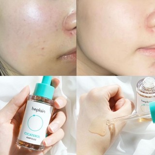 Tinh chất Beplain Cicaterol Ampoule 30ml (Nhập khẩu chính hãng)