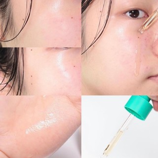Tinh chất Beplain Cicaterol Ampoule 30ml (Nhập khẩu chính hãng)