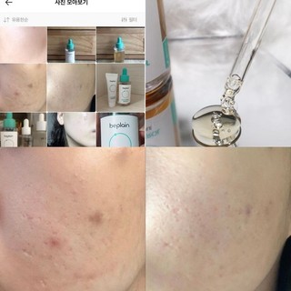 Tinh chất Beplain Cicaterol Ampoule 30ml (Nhập khẩu chính hãng)