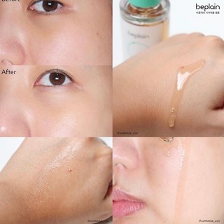 Tinh chất Beplain Cicaterol Ampoule 30ml (Nhập khẩu chính hãng)