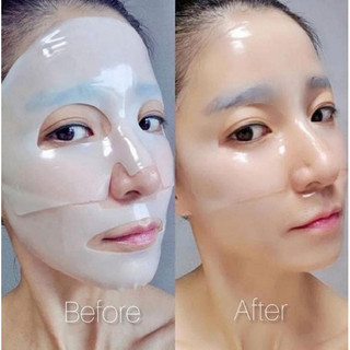 Mặt nạ thạch MEDIANSWER VITA COLLAGEN NANOSHOT MASK -  LAMII BEAUTY