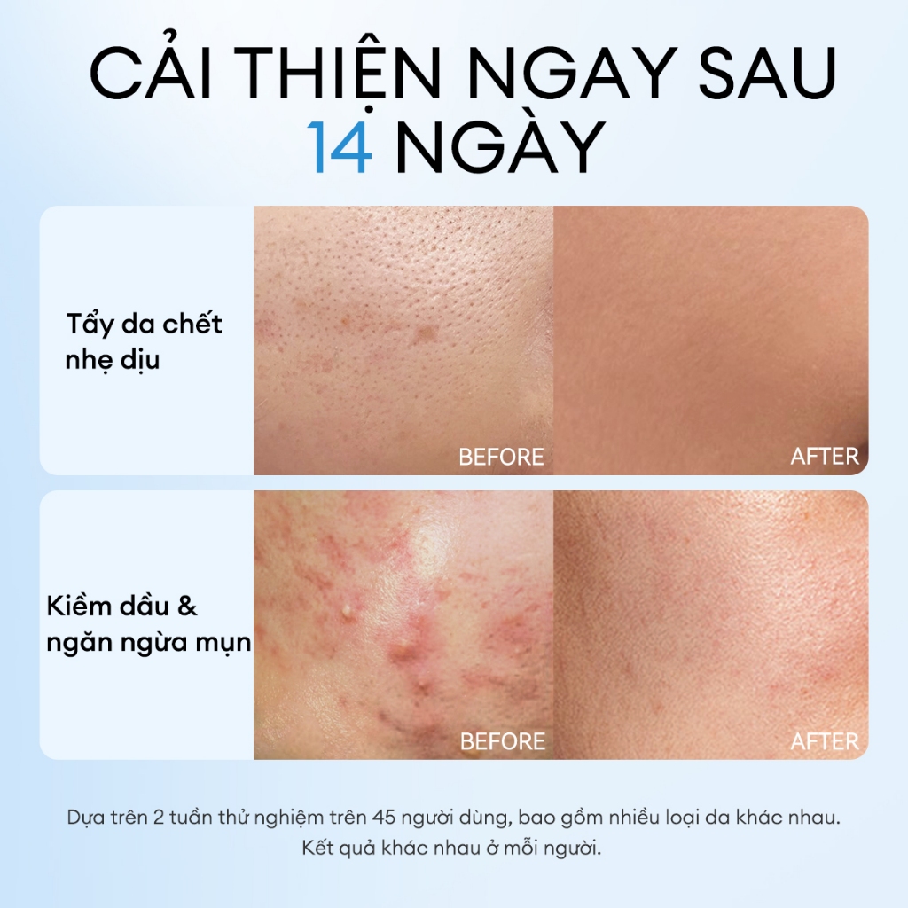 [HÀNG THANH LÝ] FOCALSKIN Toner Pad Tẩy Tế Bào Chết BHA / SALICYLIC ACID Lành Tính Kiềm Dầu Giảm Mụn | Hộp 60M | BigBuy360 - bigbuy360.vn