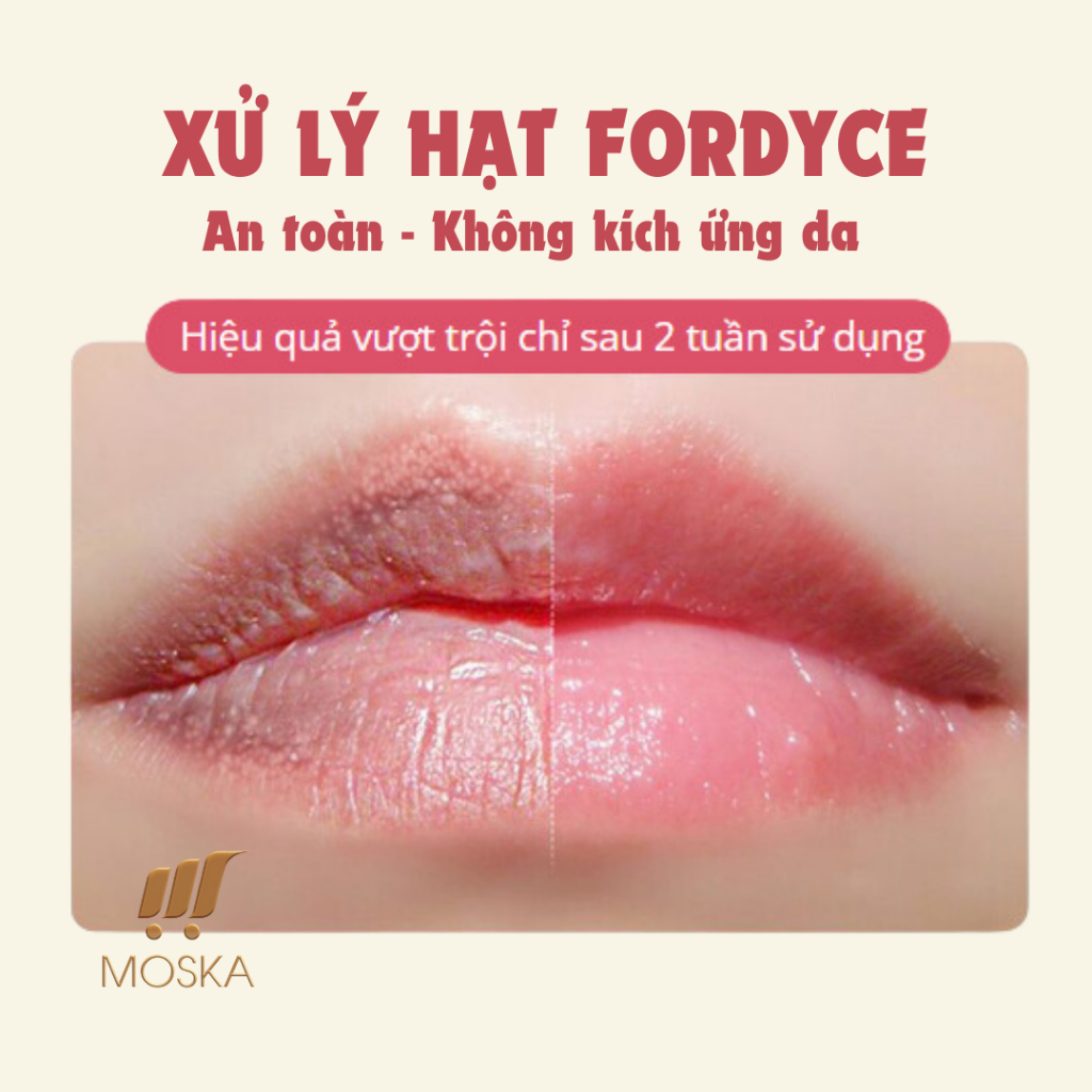 Serum Làm Hồng Môi, Dưỡng Môi, Làm Đầy Rãnh Môi, Giảm Khô Môi SAUVASINE 10ML| Moska Shop
