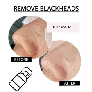 Dung Dịch Ủ Mụn Đầu Đen Remove Blackhead Medipeel 50ml