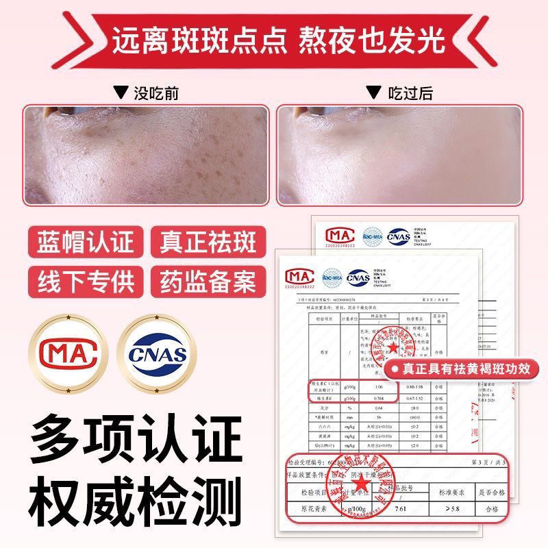 Viên Uống Trắng Da, Giảm Nám Tàn Nhang Hạt Nho Hoa Hồng Bột Proanthocyanidin Vitamin CE- Giảm Mụn, Thâm Hộp 40v
