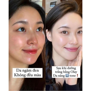 Set Kem dưỡng da Olay Total Effect