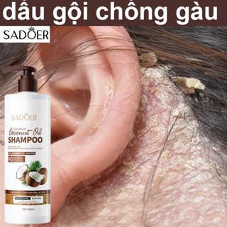 dừa dầu gội chống gàu dầu gội chống ngứa dầu gội nấm da 500ml phục hồi nang tóc da đầu nuôi dưỡng tóc kiểm soát dầu