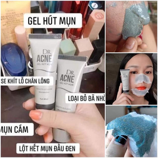 Gel lột mụn - dr.acne - hút sạch mụn cám, mụn đầu đen