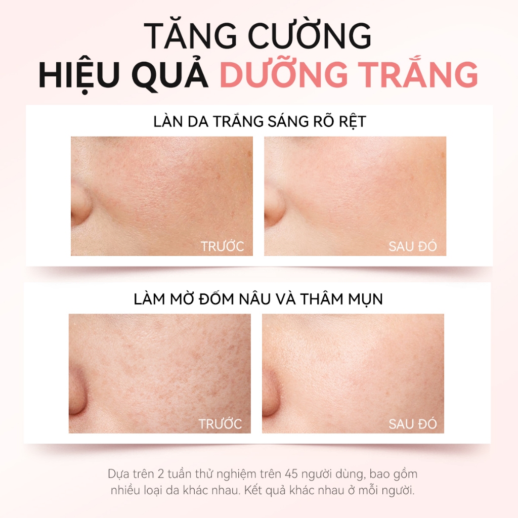 FOCALSKIN Kem Dưỡng Trắng Da Mờ Thâm Mụn Nám Đều Màu Da Vitamin C + Niacinamide +Tranexamic Acid 30g | BigBuy360 - bigbuy360.vn