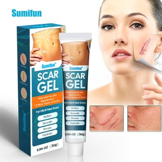Kem mờ sẹo lồi sẹo mổ đẻ sau sinh kem mờ sẹo Nga shopbanhgaobaby