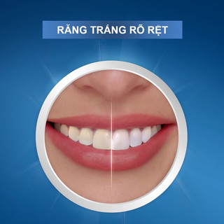 MIẾNG DÁN TRẮNG RĂNG CREST 3D WHITESTRIPS MỸ LEVEL 18