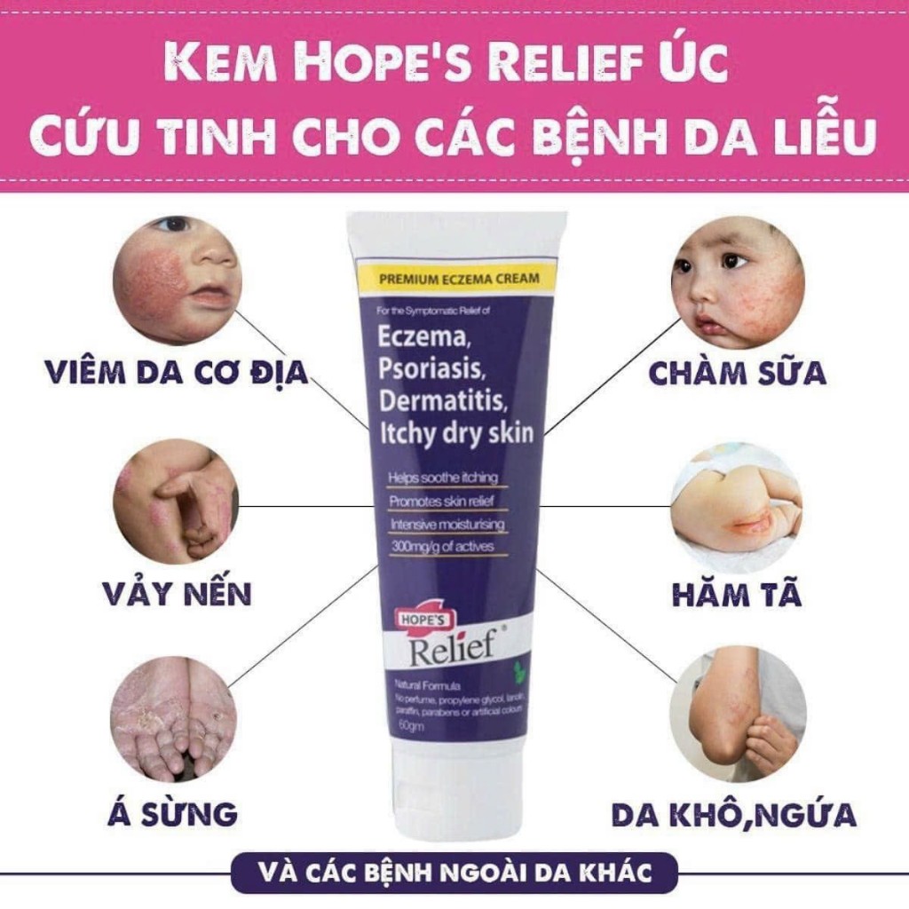 Kem bôi thảo dược Eczema, Dermatitis, Itchy Dry Skin, Hope's Relief Úc 60g-Dành cho da khô ngứa, vảy