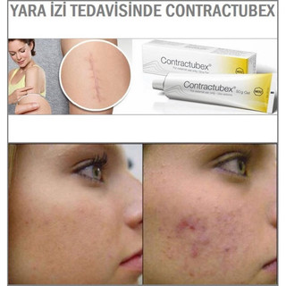 [NỘI ĐỊA ĐỨC] Kem làm mờ sẹo Contractubex (date mới)