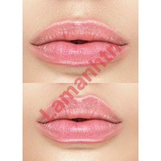 Combo 10 ảnh môi tiên filler