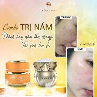  vua nghệ collagen ngày đêm kem dưỡng hỗ trợ trắng da mờ thâm nám 