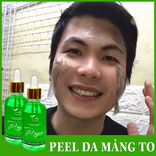 Peel da royce skin m+ peel da sành điệu nhất