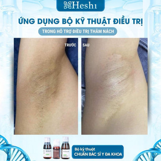 Bộ Kỹ Thuật Heshi ( lọ 1 - 2 -3 )