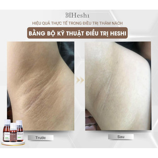 Bộ Kỹ Thuật Heshi ( lọ 1 - 2 -3 )