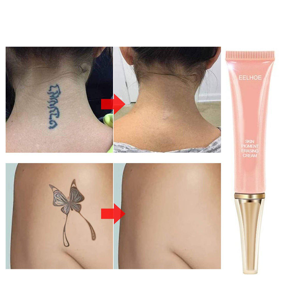 Kem Xóa Hình Xăm Vĩnh Viễn 7 Ngày Gel Xóa Hình Xăm Da Xóa Không Đau Không Sẹo Làm Sạch Hình Xăm Cơ Thể