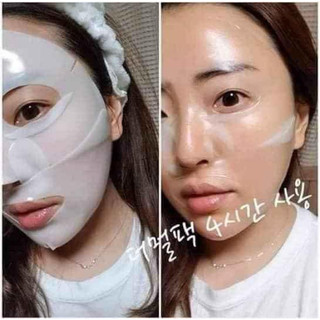 Mặt nạ thạch Derm all matrix