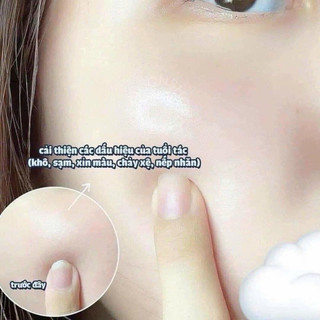 Mặt nạ thạch Derm all matrix