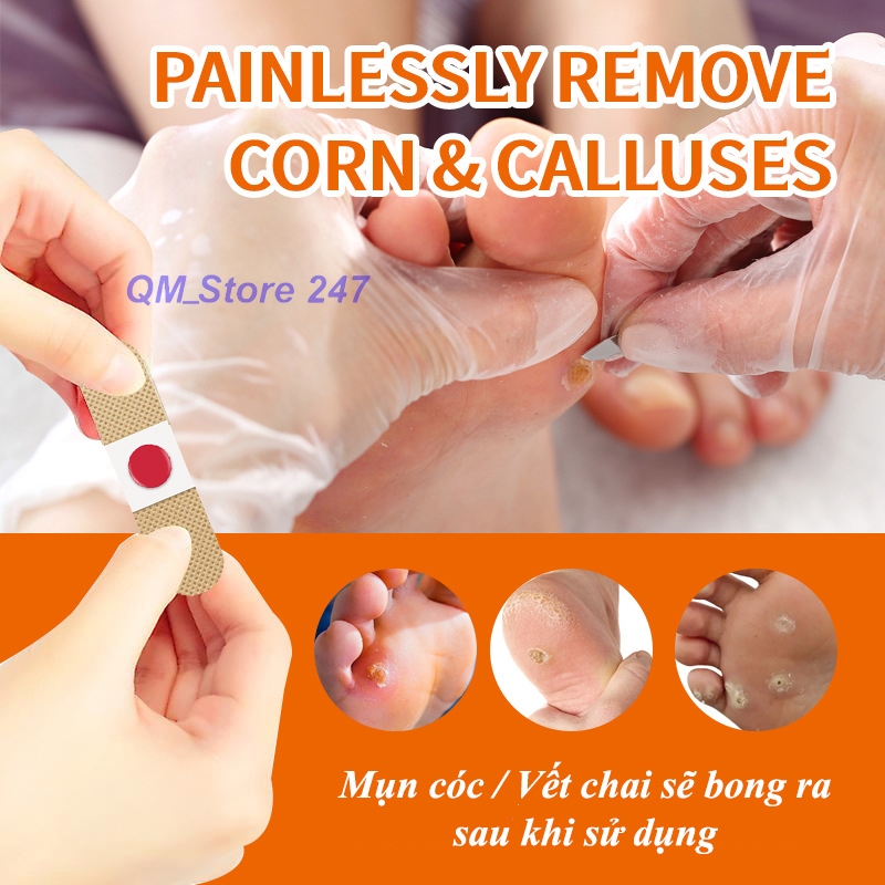 Miếng dán mụn cóc mụt cóc vết chai tẩy mụn vĩnh viễn C10 - Hộp 10 miếng