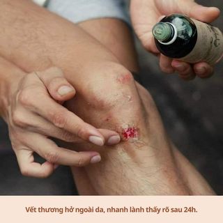 Dầu Mù U ép lạnh Noom 100ml