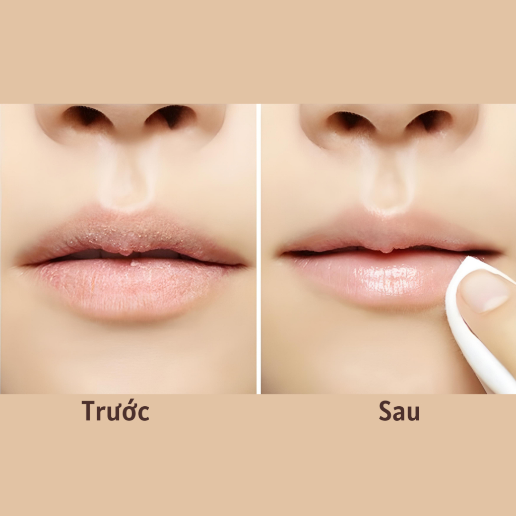 Tẩy Tế Bào Chết Cho Môi Mềm Mịn, Căng Bóng Beauty Treats 10.5g| Moska Shop