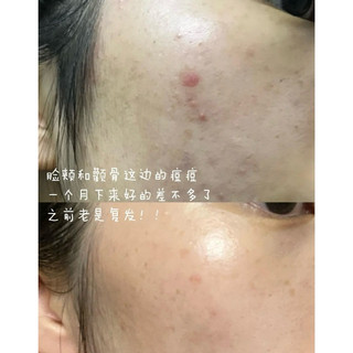 Tinh chất peel Dr Dennis Gross Alpha Beta Extra