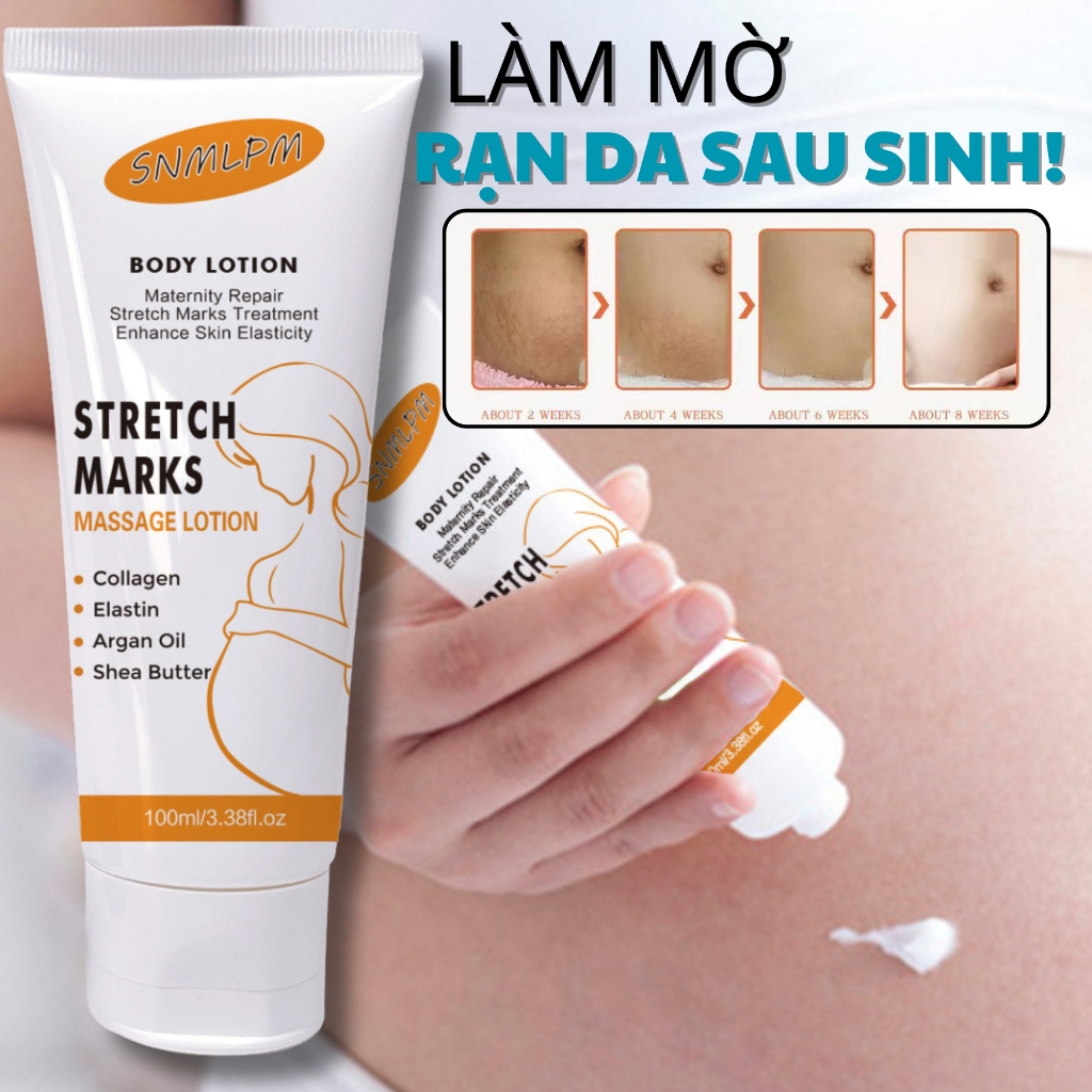Kem Rạn Da - kem Dạn Da Sau Sinh Hỗ Trợ Giảm Sẹo Sau Sinh Làm Làm Trắng Và Săn Chắc Mịn Màng SNMLPM