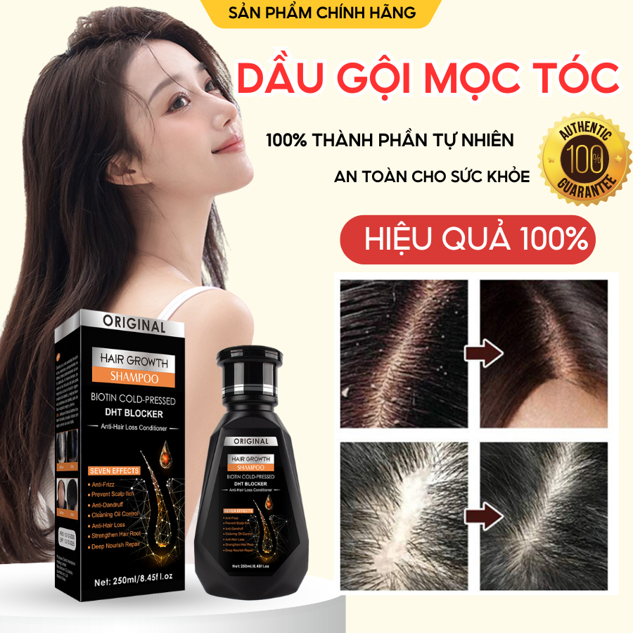 Dầu Gội Mọc Tóc ORIGINAL, Kích Thích Mọc Tóc Giảm Gàu, Nấm Ngứa, Bảo Vê Nang Tóc Chắc Khỏe