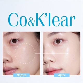 Serum Co & K’lear B5 + HA tinh chất phục hồi cấp ẩm da 50ml